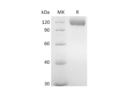 Recombinant Mouse Neuropilin-1 (C-6His)
