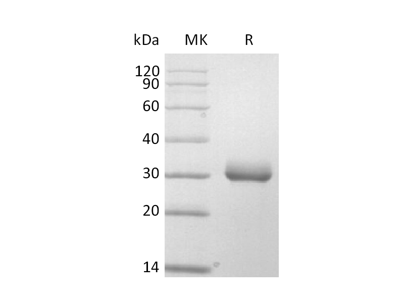 Recombinant Mouse BTNL6 (C-6His)