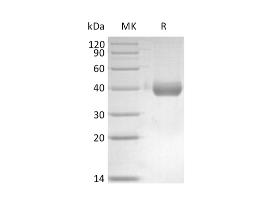 Recombinant Mouse IL-17RB (C-6His)