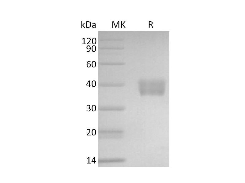 Recombinant Mouse IL-17RE (C-6His)