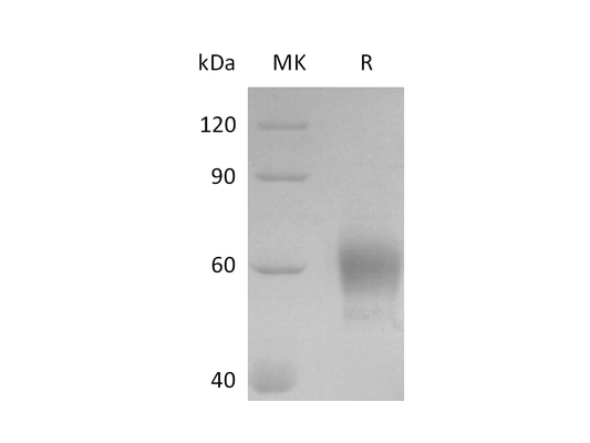 Recombinant Mouse IL-3RA (C-8His)