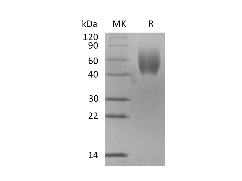 Recombinant Mouse IL-17RD (C-6His)