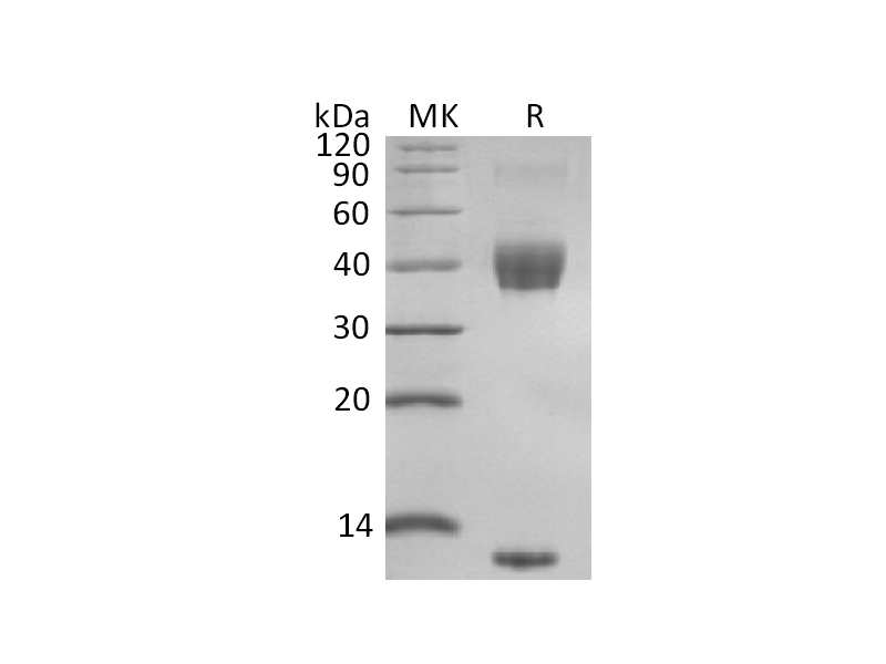 Recombinant Mouse Latent TGF-beta 1 (N-8His)