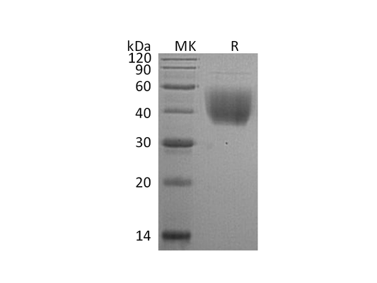 Recombinant Rat B7-1 (C-6His)