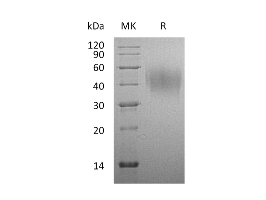 Recombinant Rat CD86 (C-6His)