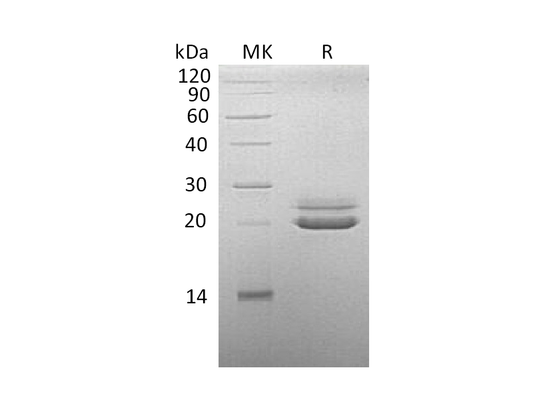 Recombinant Cynomolgus FGF-21 (C-6His)