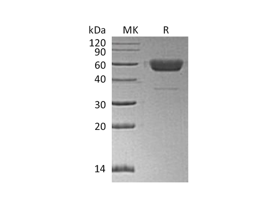 Recombinant Human/Mouse/Rat Irisin (C-Fc)