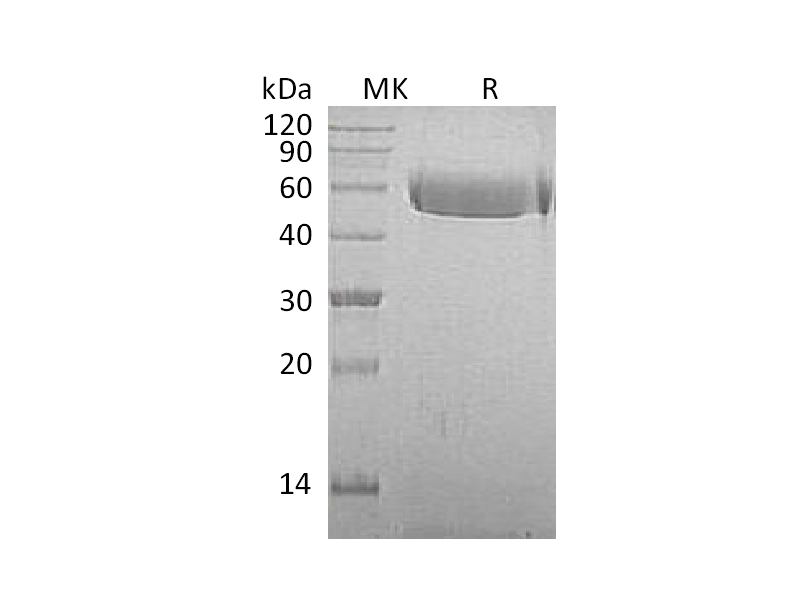 Recombinant Macaca mulatta Fetuin A (C-10His)