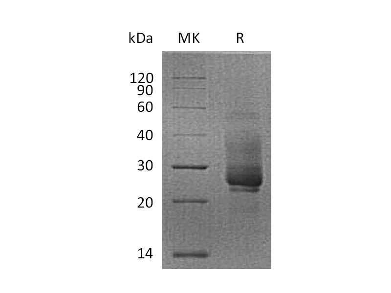 Recombinant Cynomolgus TIM-3 (N-8His)