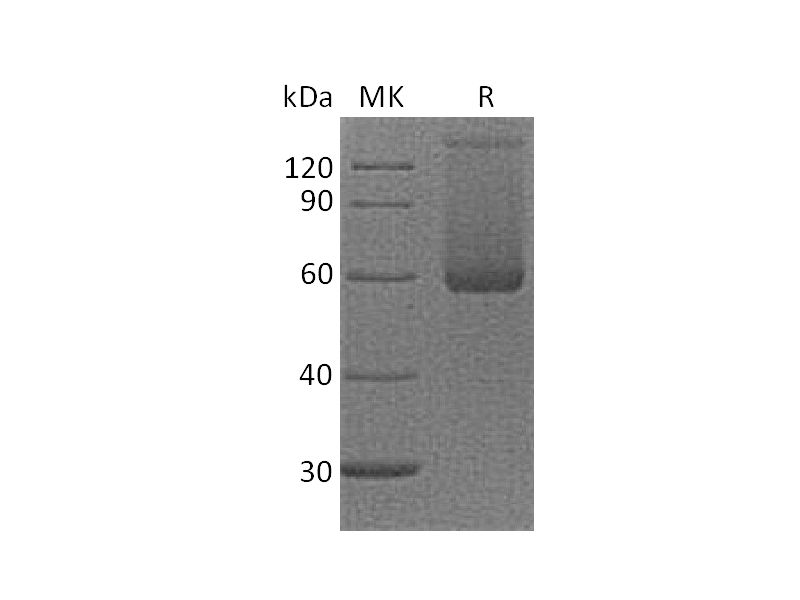 Recombinant Cynomolgus LAG-3 (N-8His)