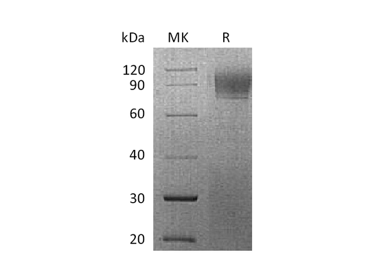 Recombinant Rhesus Macaque IFNAR1 (C-6His)
