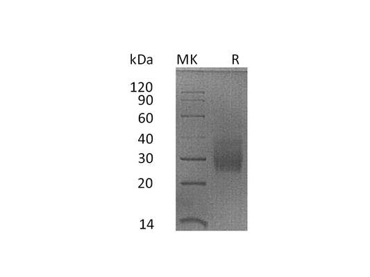 Recombinant Rhesus Macaque HVEM (C-6His)