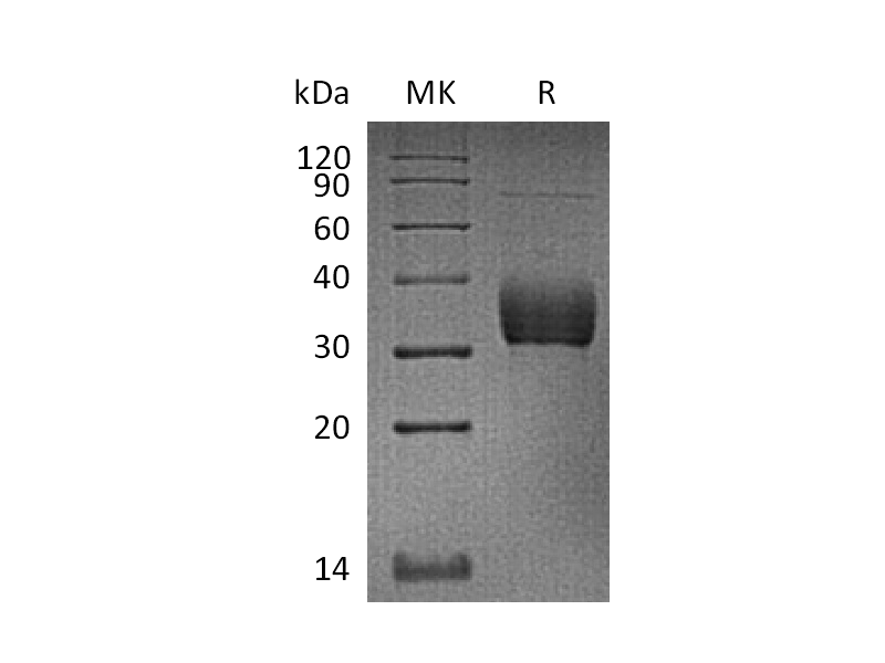 Recombinant Cynomolgus Siglec-15 (C-6His)