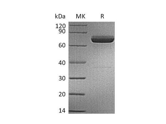 Recombinant Human IL-23A & Mouse IL-12B Heterodimer (C-6His)