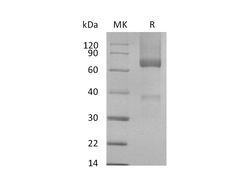 Recombinant Rhesus Macaque GPC3 (C-6His)
