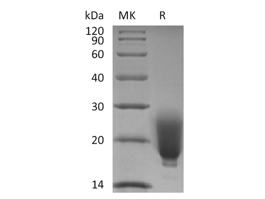 Recombinant Human/Mouse/Rat Irisin (N-6His)