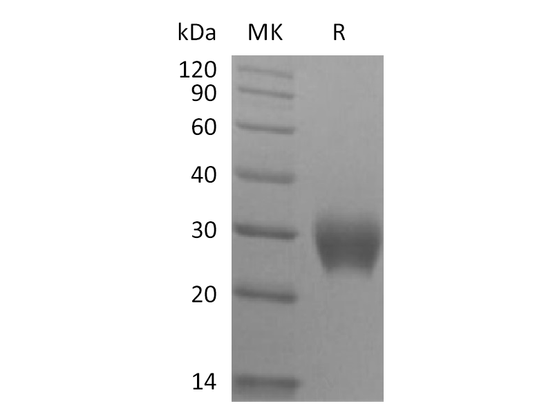 Recombinant Rhesus Macaque LAIR1 (C-6His)