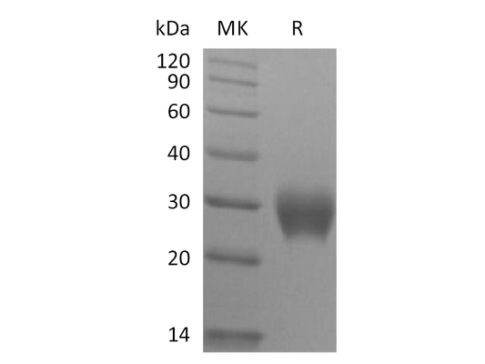 Recombinant Rhesus Macaque LAIR1 (C-6His)