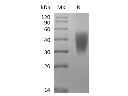 Recombinant Rhesus Macaque SLAMF7 (C-6His)