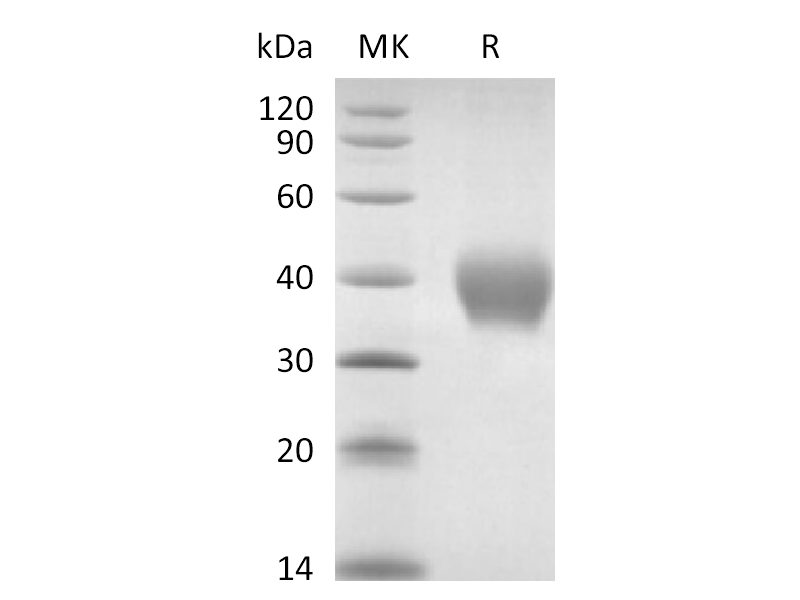 Recombinant Rhesus Macaque TNF RII (C-6His)