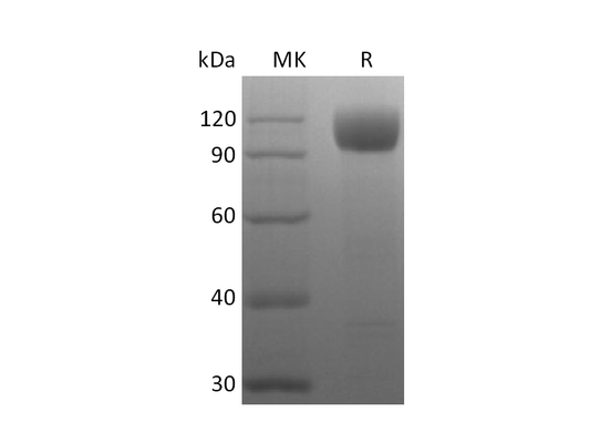 Recombinant Rhesus Macaque ACE-2 (C-10His)
