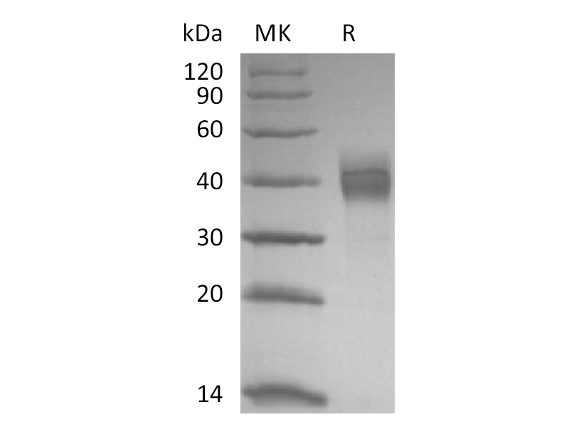Recombinant Rhesus Macaque TROP-2 (C-6His)