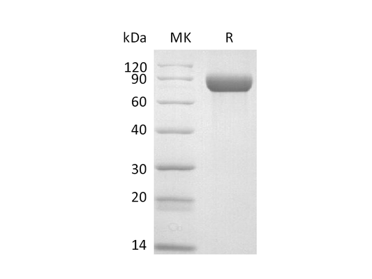 Recombinant Cynomolgus Neuropilin-1 (C-6His)