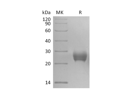 Recombinant Cynomolgus TRAIL R2 (C-6His)