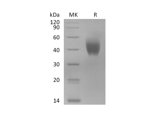 Recombinant Macaca Mulatta IL-10RA (C-6His)