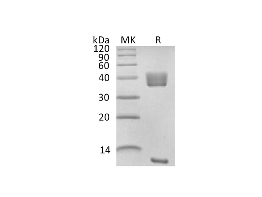 Recombinant Cynomolgus Latent TGF-beta 1 (N-6His)