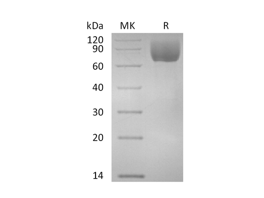 Recombinant Rhesus Macaque ICAM-1 (C-6His)