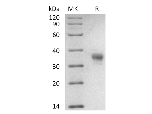 Recombinant Cynomolgus LILRB4 (C-6His)