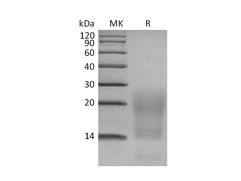 Recombinant Human BCMA (C-6His)