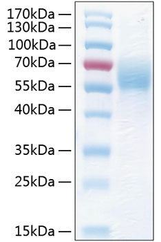 Recombinant Human THSD1 Protein