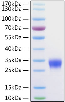 Recombinant Mouse VSIG4 Protein
