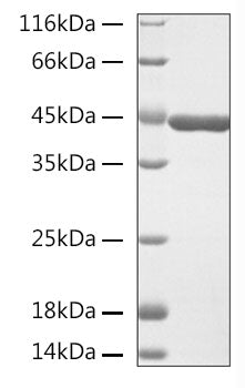 Recombinant Human Beta-actin Protein
