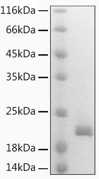 Recombinant Mouse Lymphotactin/XCL1 Protein
