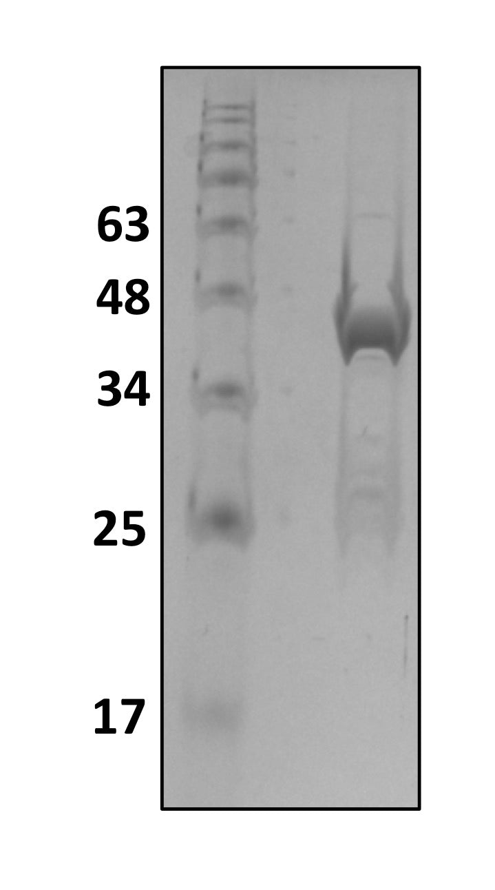 Recombinant Human Josephin-2/JOSD2 protein