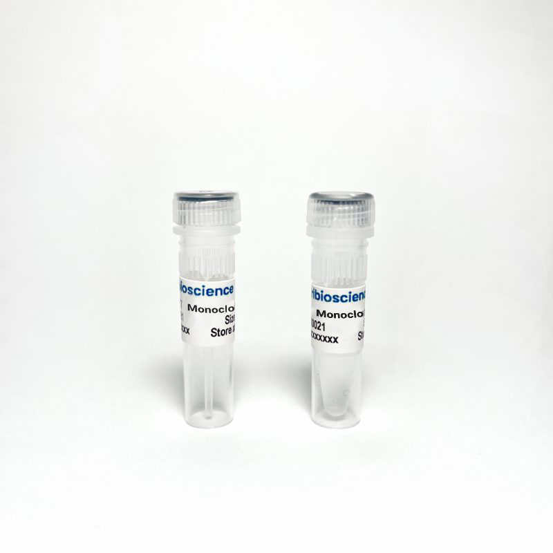E2F1 Rabbit Monoclonal Antibody (TBS10265) - 20 uL
