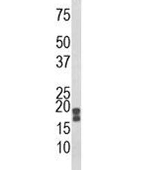Western blot analysis of ACP1 antibody and human HeLa lysate. Predicted molecular weight 14-18 kDa (