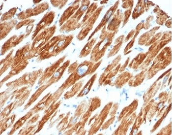 IHC staining of FFPE human cardiac muscle tissue with Desmin antibody (clone DES/3255) at 2ug/ml. HI