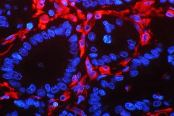 Vimentin Antibody