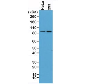 Beta Catenin Antibody / CTNNB1