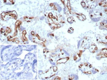 FABP4 Antibody