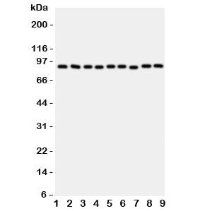 Western blot testing of VCP antibody and rat samples 1: brain; 2: kidney; 3: liver; 4: lung; and hum