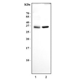 NGF Antibody / Beta Nerve Growth Factor