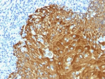 Pan Cytokeratin Antibody Cocktail (Acidic + Basic)