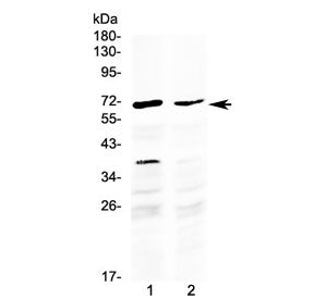 MAK Antibody / Male germ cell-associated kinase (C-Terminal Region)