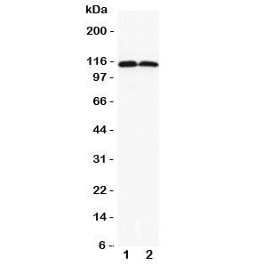 Western blot testing of DOG1 antibody and Lane 1) rat liver; 2) rat skeletal muscle lysate. Expected