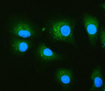 Immunofluorescent staining of FFPE human A549 cells with Glucosidase 2 subunit beta antibody (green)